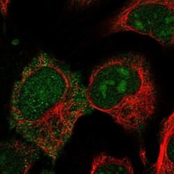 CRIP2 Antibody, Novus Biologicals:Antibodies:Primary Antibodies